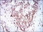 SKP1 Antibody